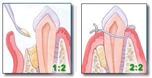 Dr. Hogan, Gum Grafting, Columbia Periodontist, South Carolina, SC